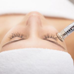 microdermabrasian