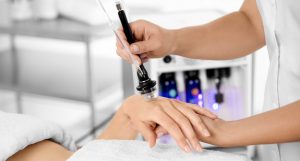 SilkPeel Microdermabrasion