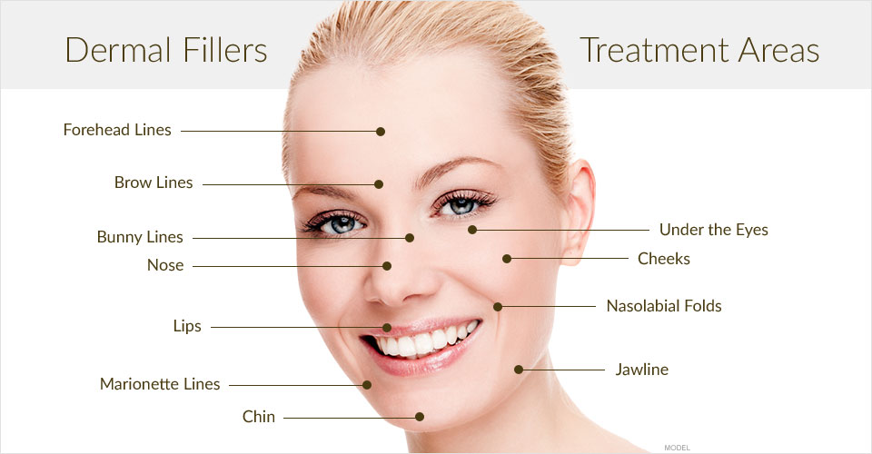 Dermal Filler Treatment Areas